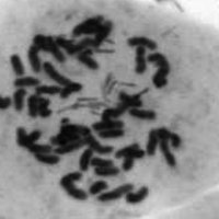 8. Chromosomes of a hexaploid Centaurea stoebe plant (photo-copyright: Patrik Mráz)